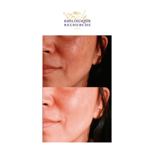 Brithening Pigm 400 Facial